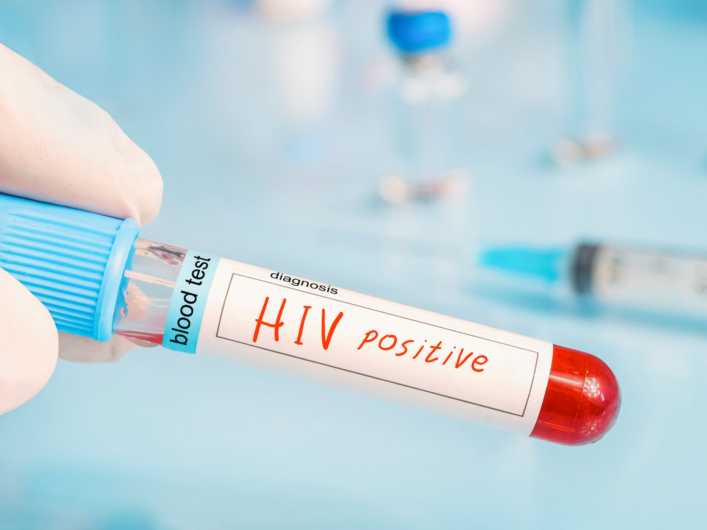 《愛滋》蛹化蛻變另個自我丨阿浩【POZstory陽性故事】(標題圖檔)